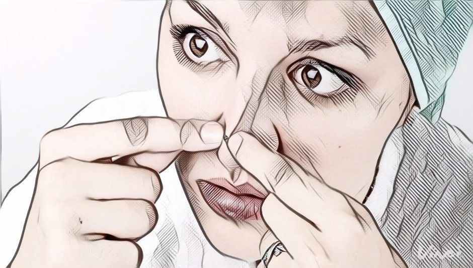 Cómo evitar los puntos negros