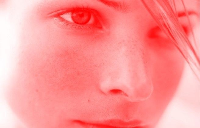 Pieles alérgicas y ultrasensibles: como cuidarlas